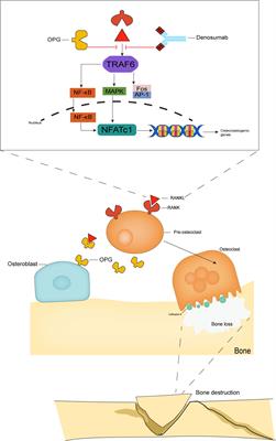 Current comprehensive understanding of denosumab (the RANKL neutralizing antibody) in the treatment of bone metastasis of malignant tumors, including pharmacological mechanism and clinical trials